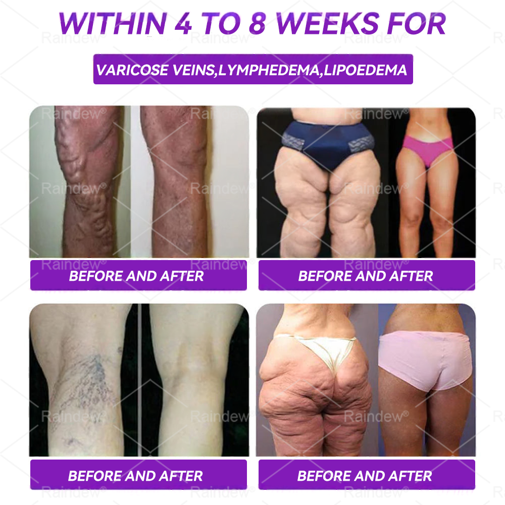 Recommended by UCLH, University College London Hospitals| Official Store | Raindew® 💎𝐆𝐋𝐏-𝟏 𝐨𝐫𝐚𝐥 𝐥𝐢𝐪𝐮𝐢𝐝--✅Revolutionary GLP-1 Scientific Sugar Control and Weight Loss Programs