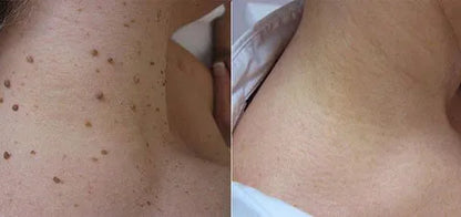 💍（LAST DAY SALE-80% OFF)Fast Dark Spot Remover-𝗖𝗼𝗼𝗹𝗼𝗿𝗱™ Melanin Correcting Brightening Serum