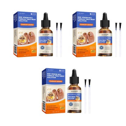 HONXI™ Bee Venom Nail Folliculitis Treatment Program: The Complete Solution to Nail Folliculitis🌟👣
