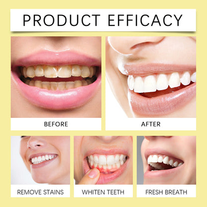 HONXI™ Focussmile Bee Venom Advanced Tooth Cleaning Powder🦷 (BDA Recommended)