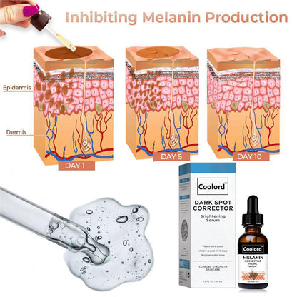 💍（LAST DAY SALE-80% OFF)Fast Dark Spot Remover-𝗖𝗼𝗼𝗹𝗼𝗿𝗱™ Melanin Correcting Brightening Serum