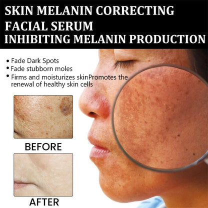 💍（LAST DAY SALE-80% OFF)Fast Dark Spot Remover-𝗖𝗼𝗼𝗹𝗼𝗿𝗱™ Melanin Correcting Brightening Serum