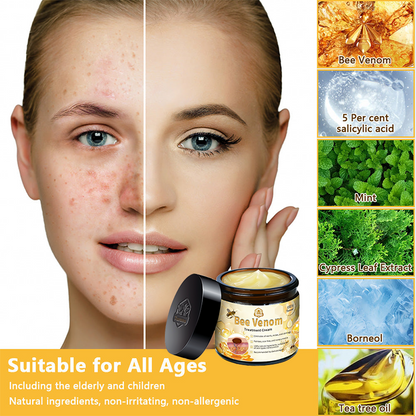 UK (MHRA Recommended) Turonu Bee Venom Treatment cream (last day promotion 80% off)