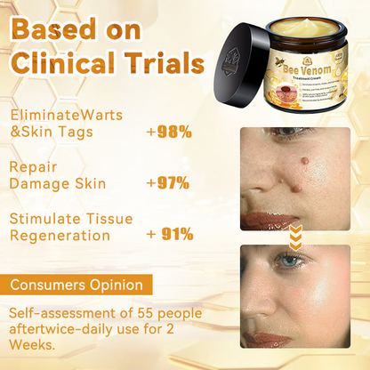 UK (MHRA Recommended) Turonu Bee Venom Treatment cream (last day promotion 80% off)