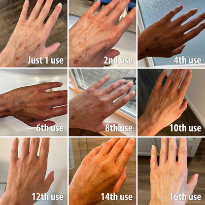 💍（LAST DAY SALE-80% OFF)Fast Dark Spot Remover-𝗖𝗼𝗼𝗹𝗼𝗿𝗱™ Melanin Correcting Brightening Serum