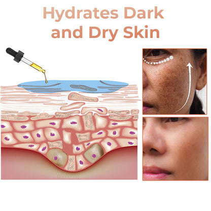 💍（LAST DAY SALE-80% OFF)Fast Dark Spot Remover-𝗖𝗼𝗼𝗹𝗼𝗿𝗱™ Melanin Correcting Brightening Serum